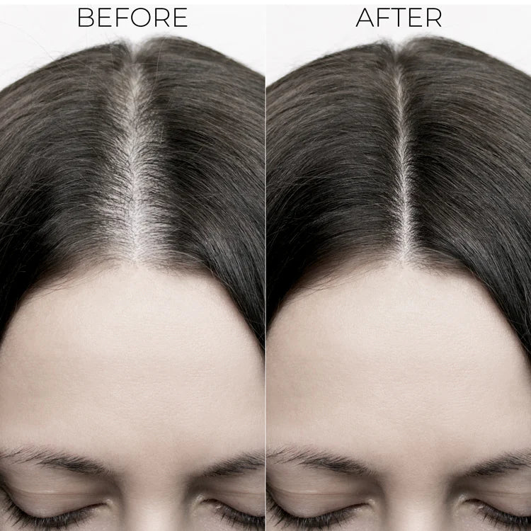 Brillare Hair Fall Control Conditioner – Strengthens Roots & Reduces Seasonal Hair Fall